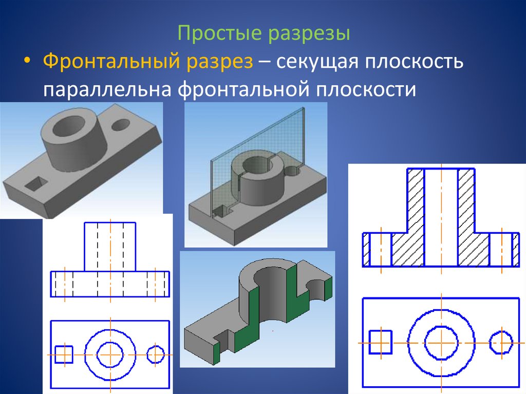 Фронтальный разрез правильно выполнен на рисунке