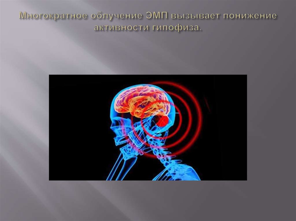 Мозг магнитное поле. Электромагнитное поле мозга. Воздействие на мозг электромагнитными полями. Облучение ЭМП. ЭМП вызывает.