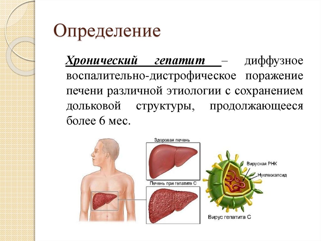Диффузный гепатит. Хронический вирусный гепатит с. Острый и хронический гепатит.