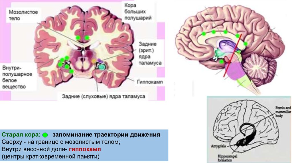 Подкорковые поражения мозга. Поражение подкорковых ядер мозга. Подкорковые структуры мозга. Подкорковые узлы полушарий.