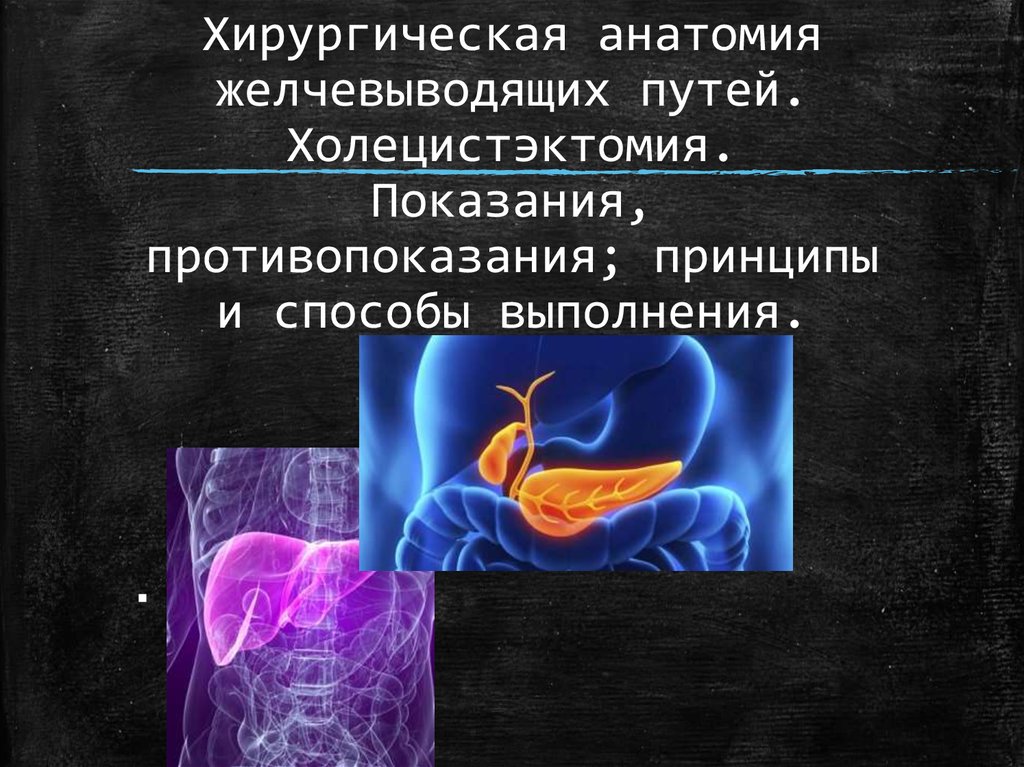 Хирургическая анатомия. Хирургическая анатомия желчевыводящих путей. Холецистэктомия показания. Показания и противопоказания к холецистэктомии. Холецистэктомия анатомия желчевыводящих путей.