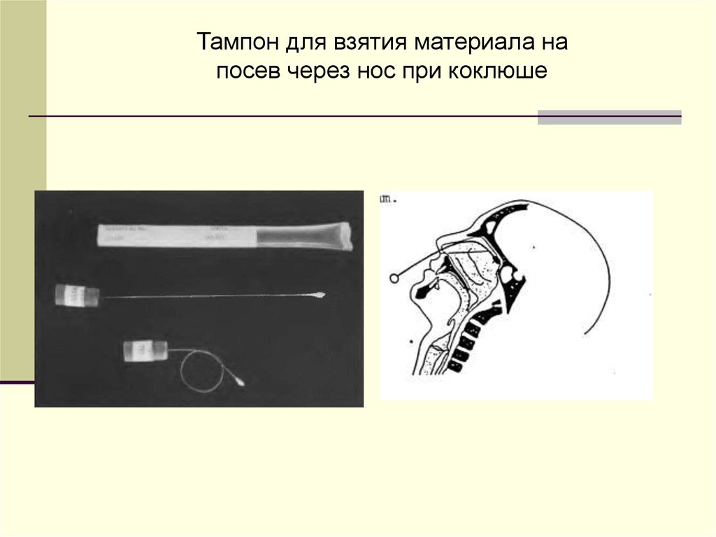 Взятие материала. Взятие мазка на коклюш алгоритм. Взятие материала на коклюш. Коклюш методом кашлевых пластинок.