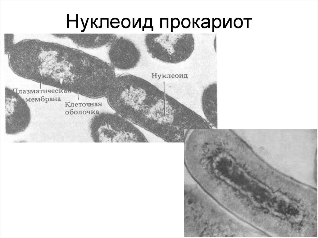 Нуклеоид прокариот. Нуклеоид бактерий. Нуклеоид это в микробиологии. Нуклеоид функции микробиология. Нуклеоид бактериальной клетки.
