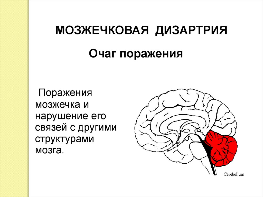 Проект по дизартрии