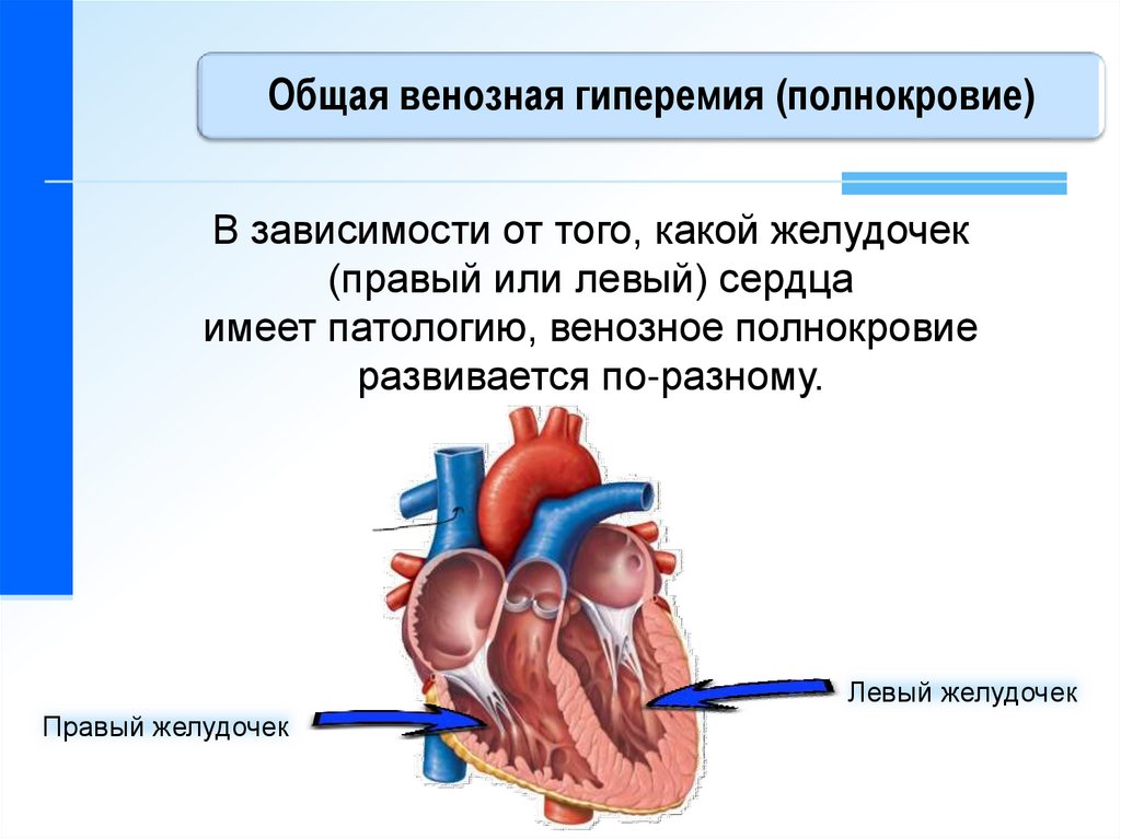 Венозный застой