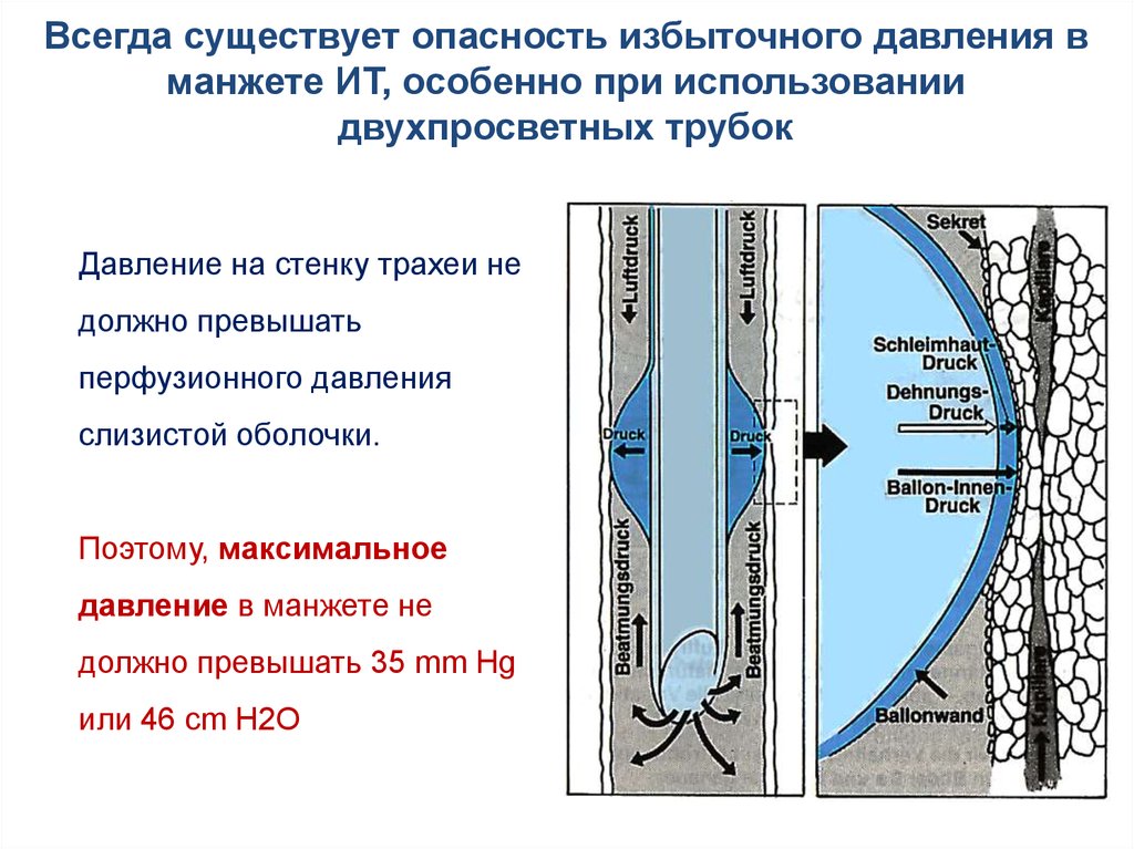 Как обеспечить проходимость. Методы обеспечения газообмена в легких. Перечислите методы обеспечения газообмена в легких. Методы обеспечения газообмена в легких 3.