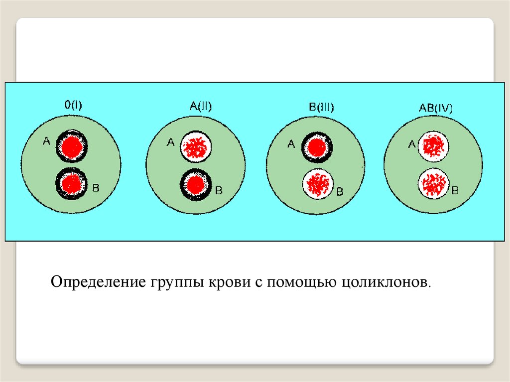 Группа крови по цоликлонам