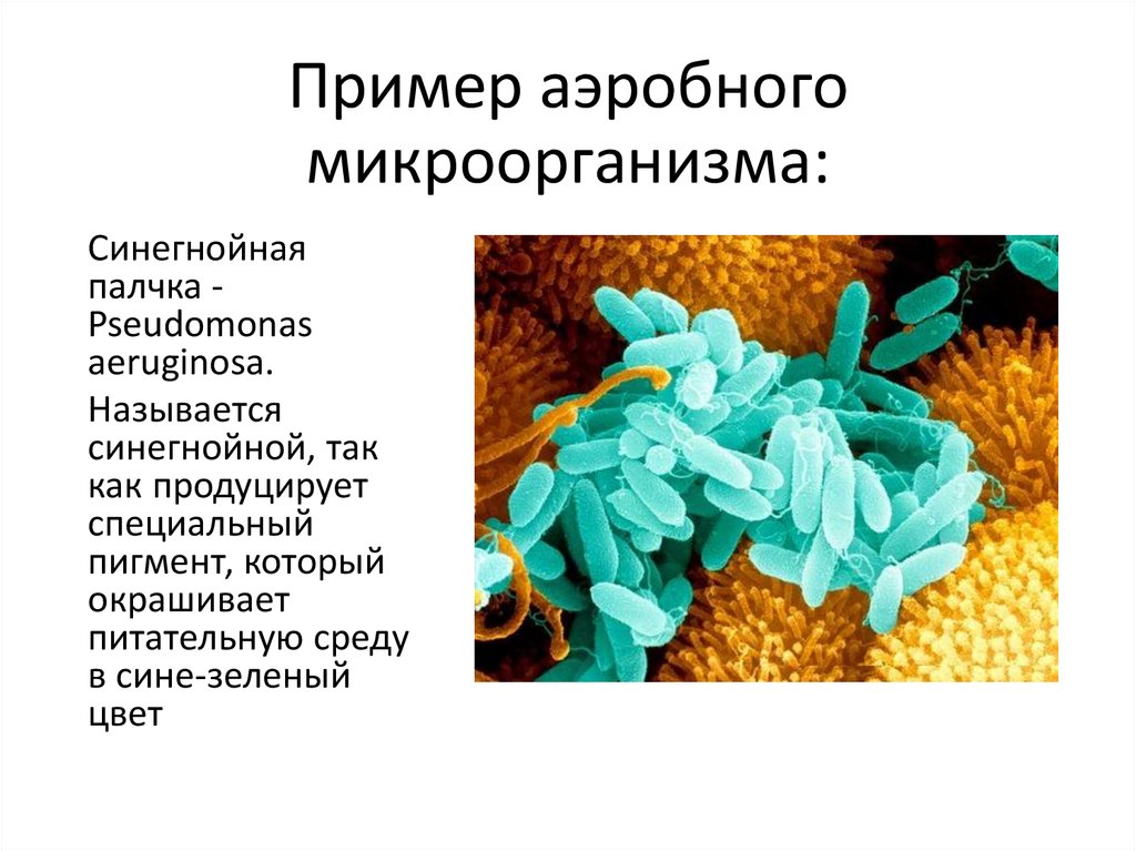 Бактерии примеры. Аэробные и анаэробные бактерии. Аэробные бактерии микробиология. Бактерии анаэробы. Бактерии аэробы и анаэробы.