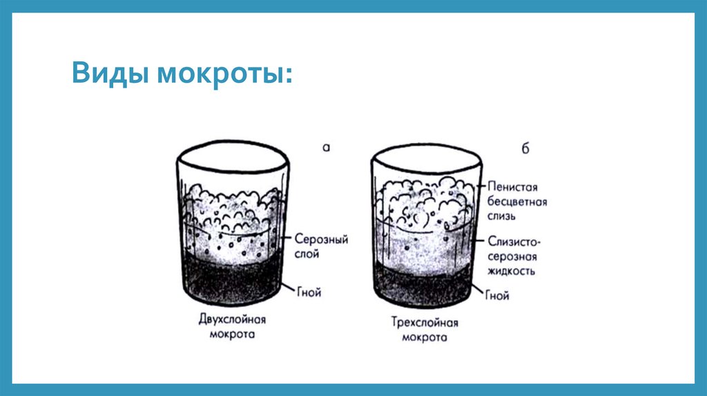 Презентация на тему мокрота