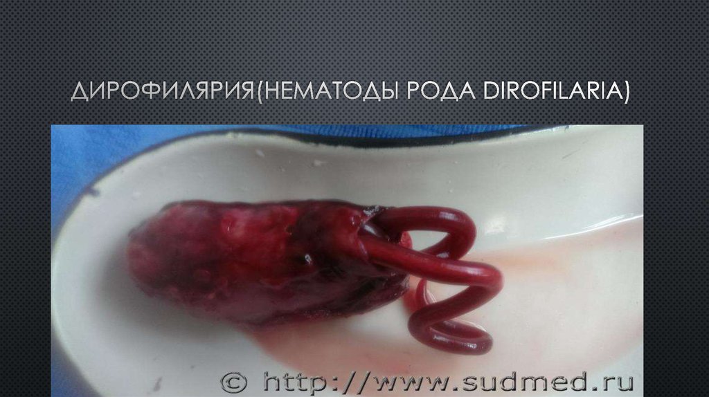 Дирофилярия(нематоды рода Dirofilaria)