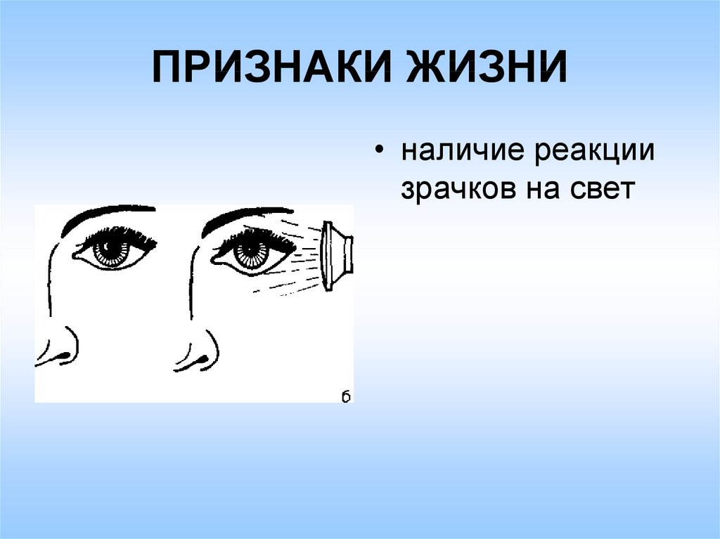 Жизненные признаки. Признаки жизни. Основные признаки жизни человека. Наличие реакции зрачков на свет.