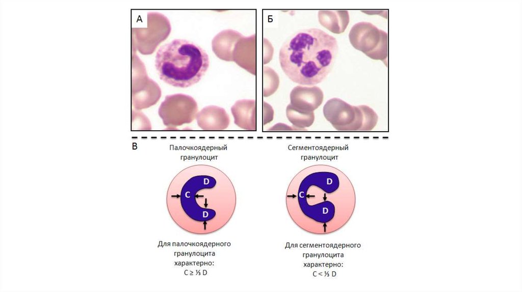 Палочкоядерные нейтрофилы фото