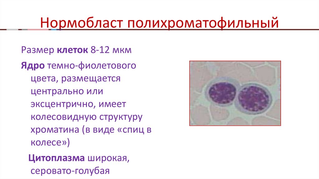 Нормобласты. Полихроматофильный нормобласт. Виды нормобластов. Олихроматофильный жритробласт ядро. Полихроматофильный эритробласт цитоплазма.