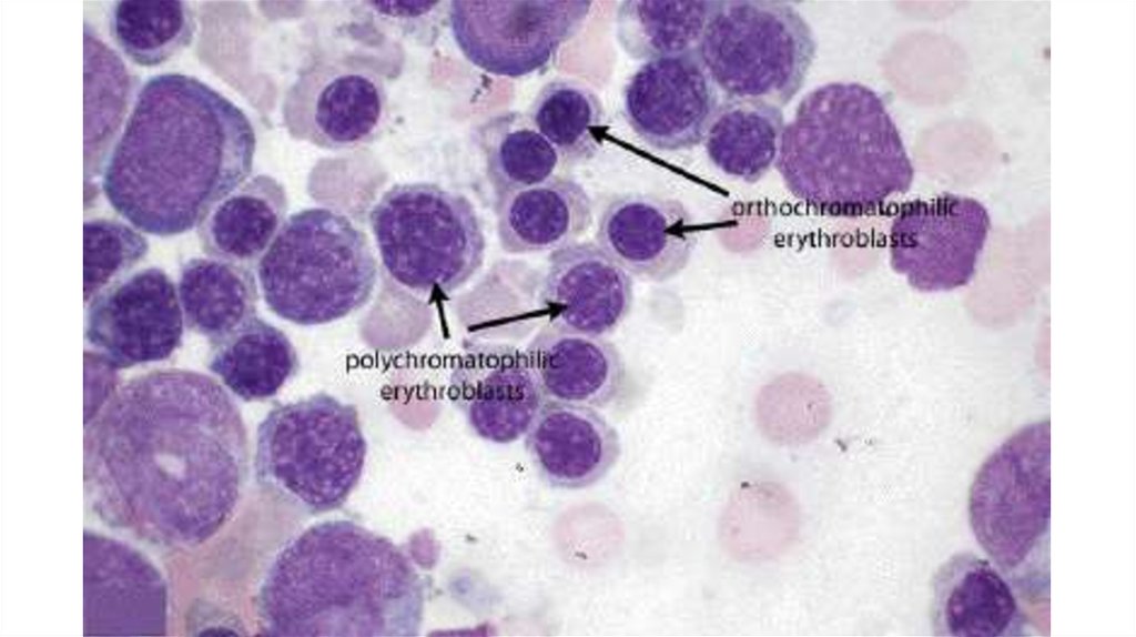 Нормобласты в крови картинки