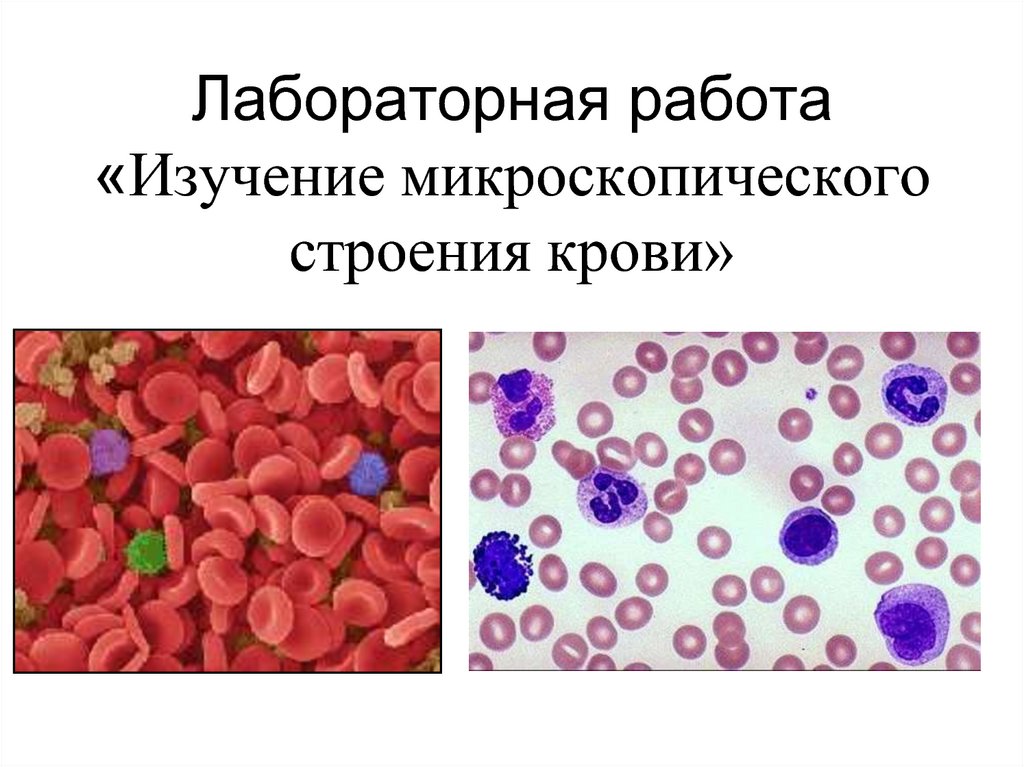 Лабораторная работа кровь лягушки. Изучение микроскопического строения крови. Изучение строения клетки крови лягушки. Изучение микроскопического строения крови человека и лягушки. Строение клетки крови лягушки 5 класс биология.