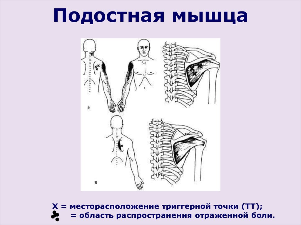 Подостная мышца. Подостная мышца прикрепление. Подостная мышца лопатки. Триггерные точки подостной мышцы. Функция подостной мышцы.