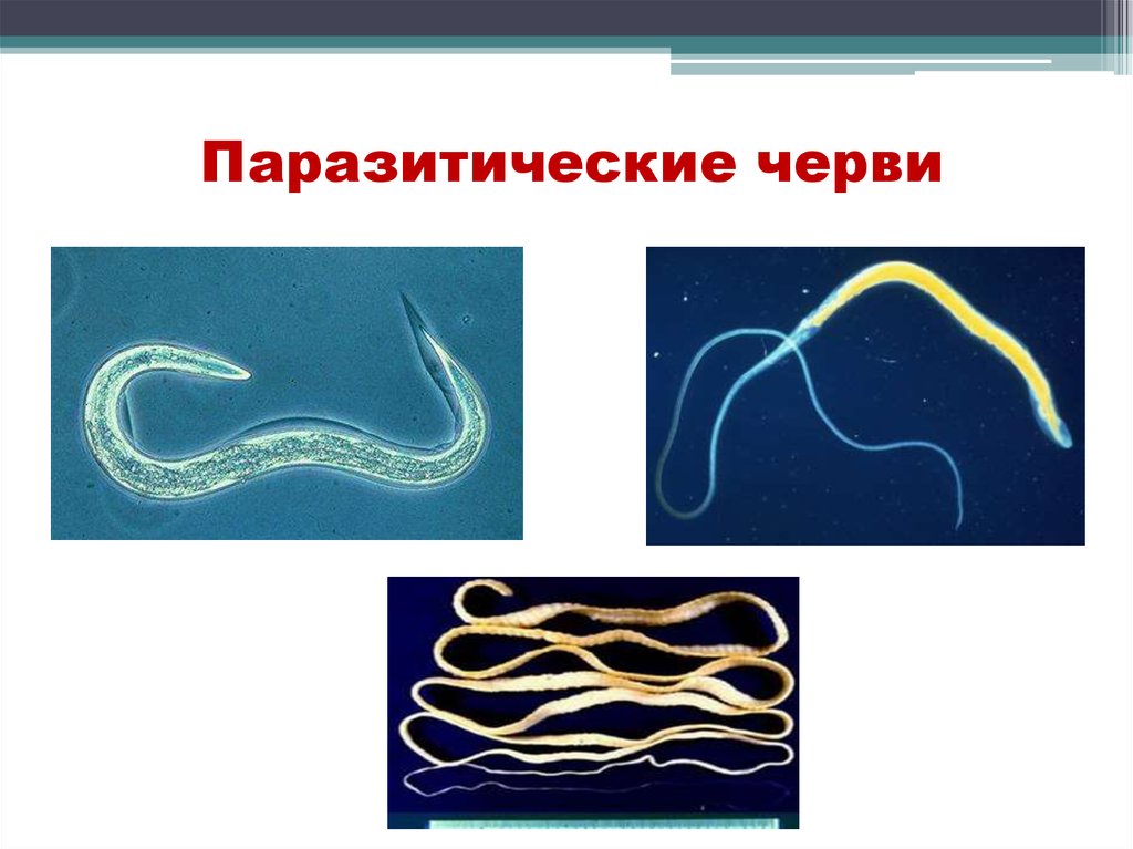 Ленточные черви образ жизни. Черви и паразитические черви заболевания. Паразитические черви представители.