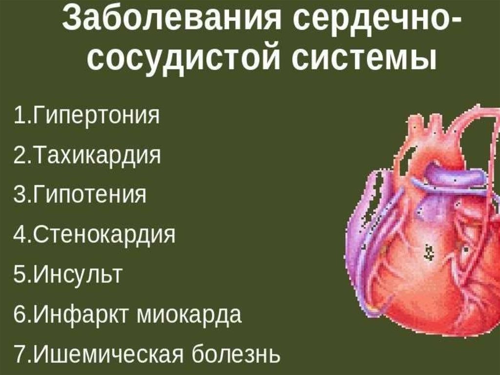 Сердечные заболевания прием. Заболевания сердечно-сосудистой системы. Заболевание серлечнососудистрй системы. Заболевания сердечно сердечно сосудистые системы. Перечислите заболевания сердечно сосудистой системы.