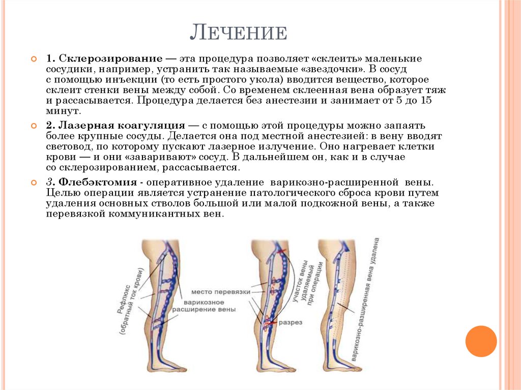 Лечение нижних конечностей