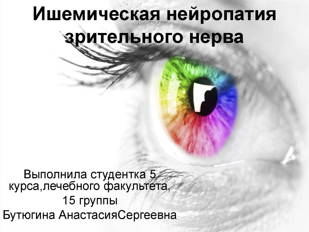 Нейропатия глаза. Ишемическая оптическая нейропатия. Нейропатия зрительного нерва. Ишемическая нейропатия зрительного нерва. Ишемическая нейропатия глаза.