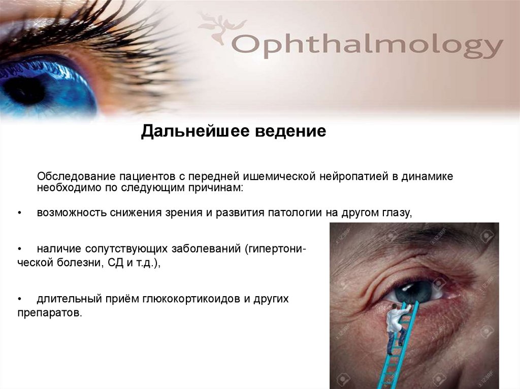Ишемическая оптическая нейропатия. Нейропатия зрительного нерва. Передняя ишемическая нейропатия зрительного. Нейропатия глаза