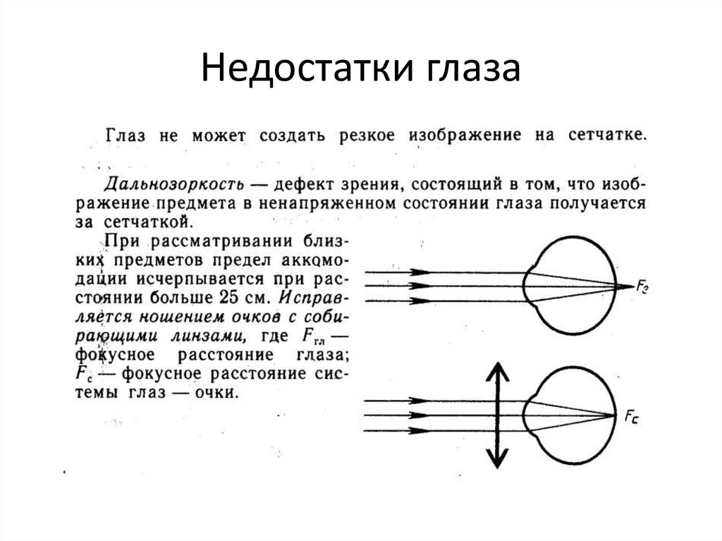 Линзы для зрения дальнозоркость