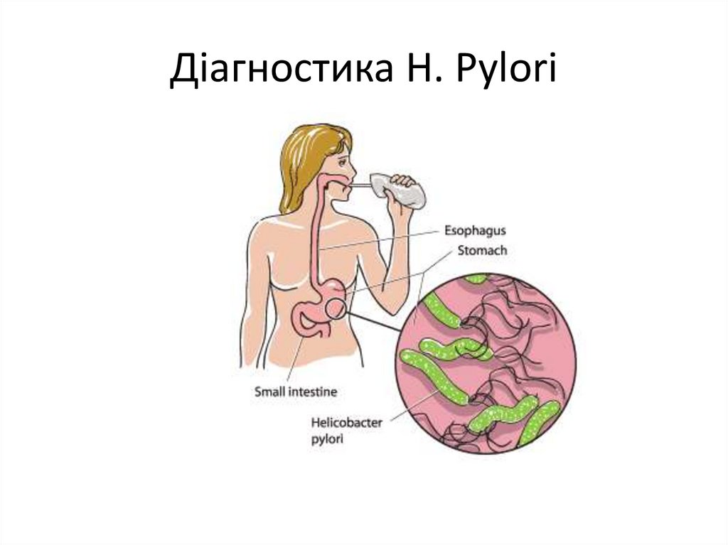 Діагностика H. Pylori