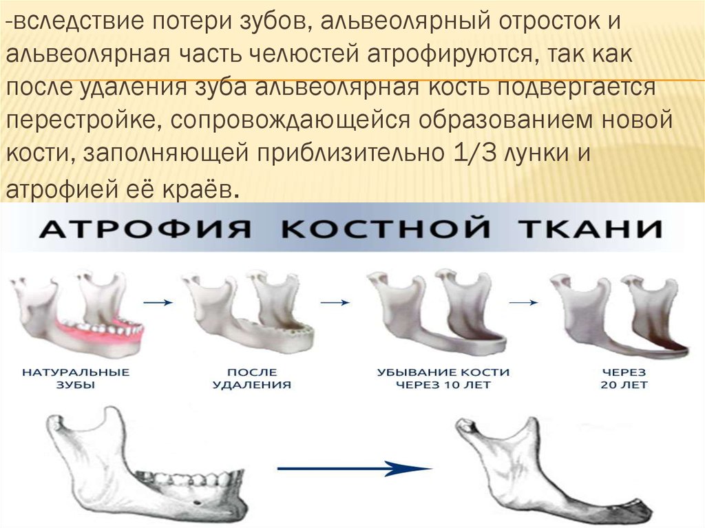 Старческая прогения фото