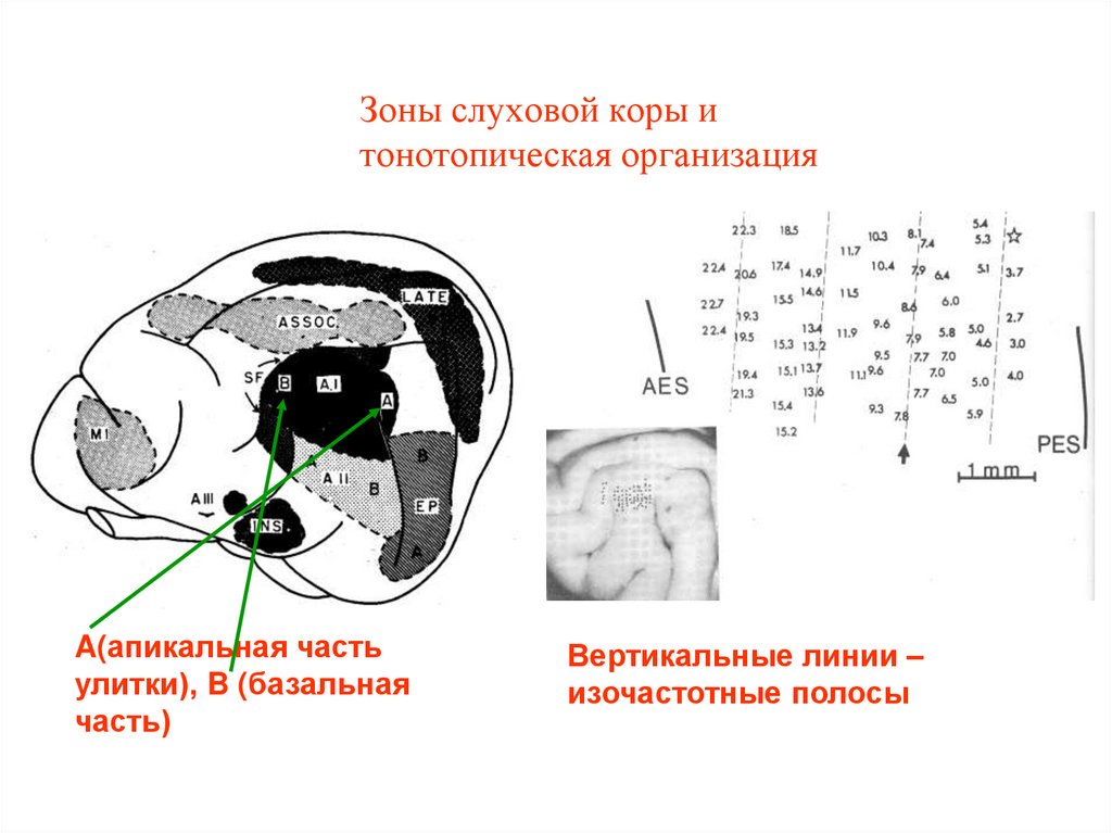 Мозг зона слуха