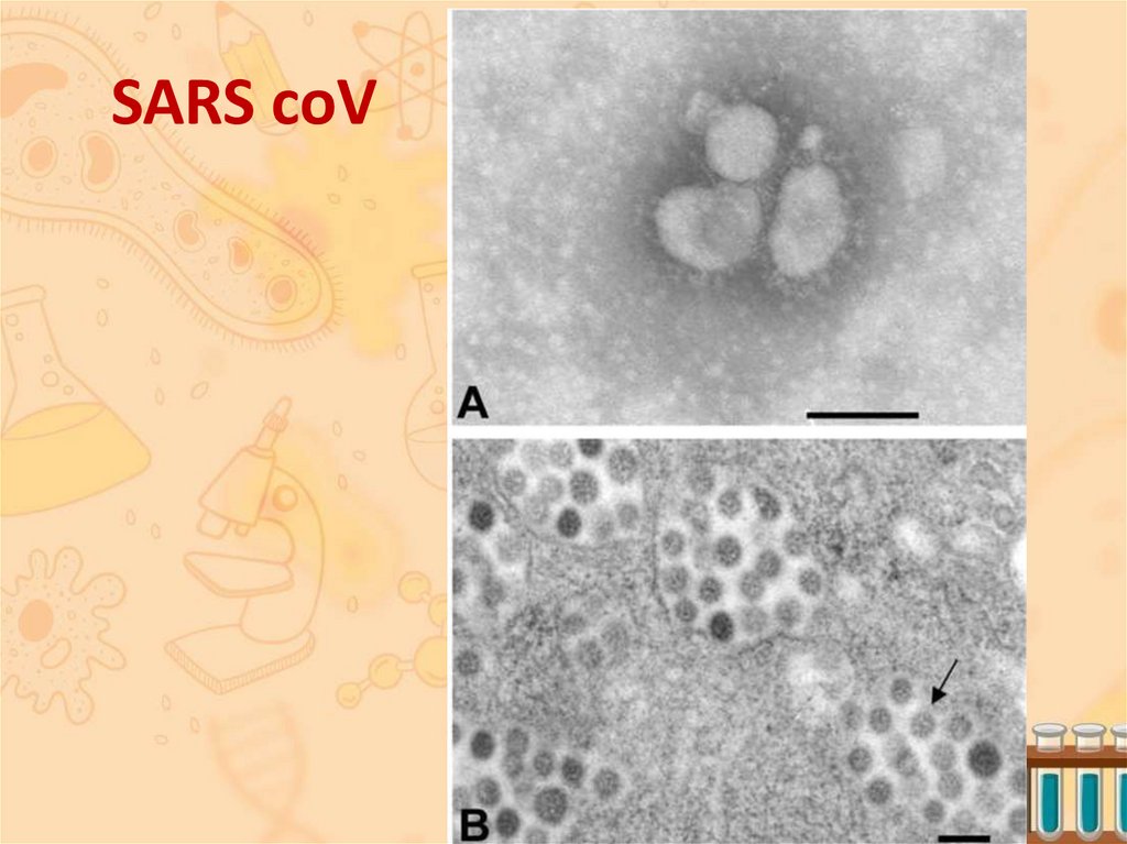 SARS coV