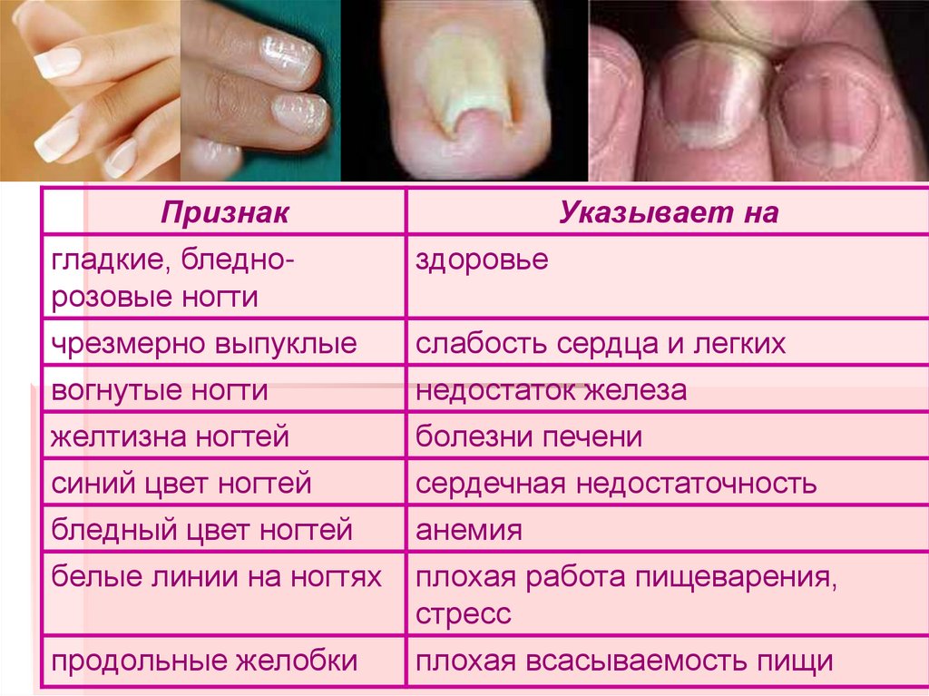 Наличие ногтевых пластин