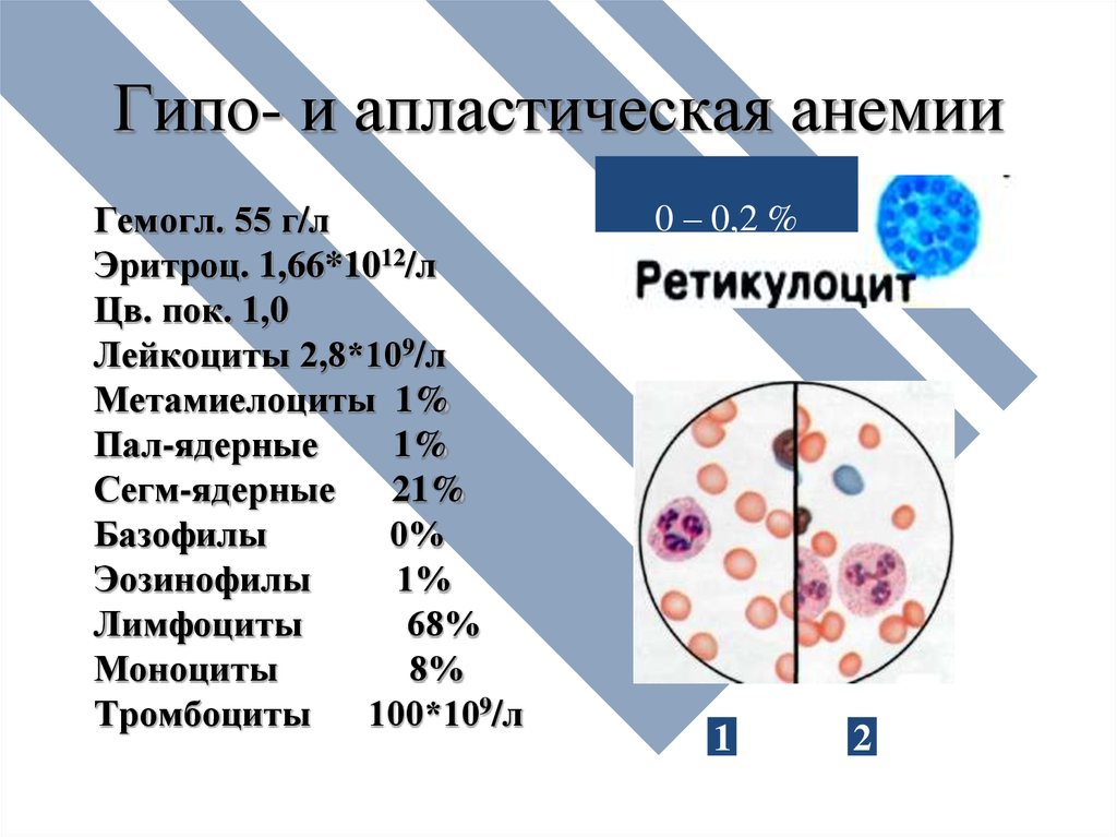 Показатели анемии в анализе