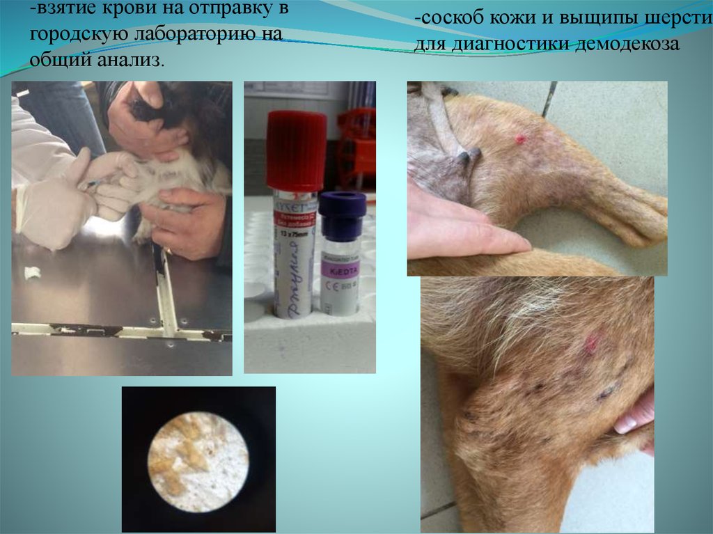 -взятие крови на отправку в городскую лабораторию на общий анализ.