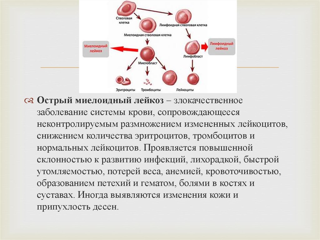 Миелоидный лейкоз. Механизмы развития острого миелобластного лейкоза. Миелоидные и лимфоидные лейкозы. Миелоидный лейкоз тромбоциты. Острый миелобластный лейкоз картина крови этиология патогенез.