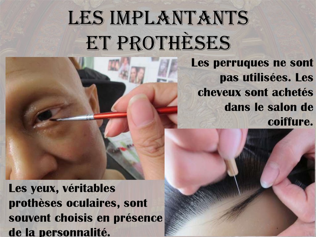 Les implantants et prothèses