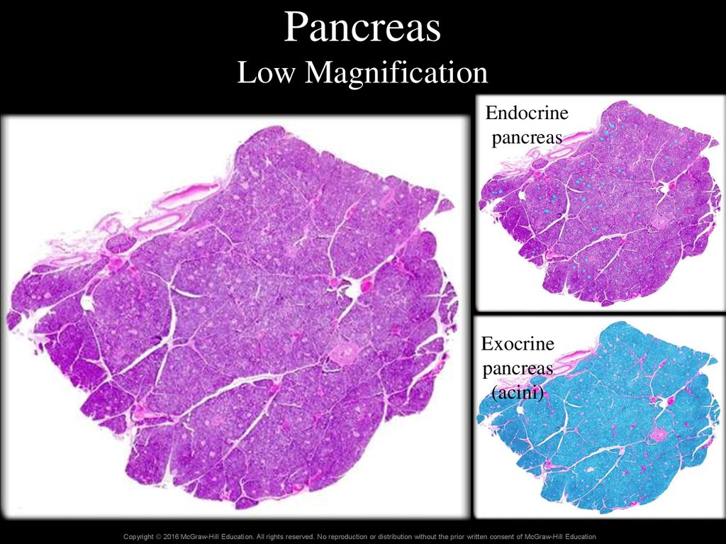 Pancreas Low Magnification
