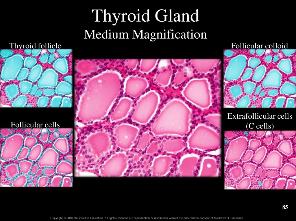 Thyroid Gland Medium Magnification