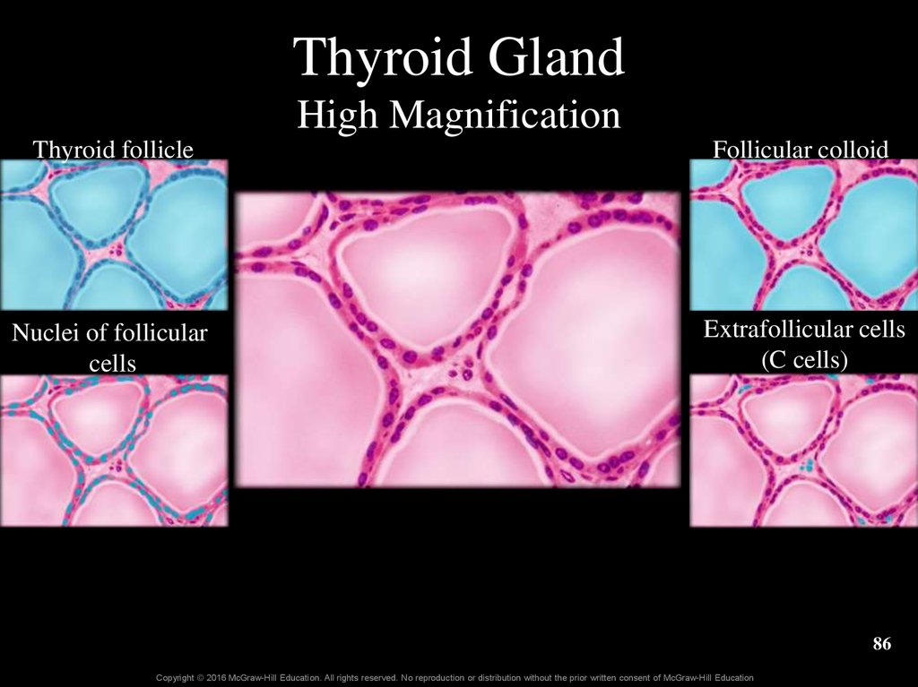 Thyroid Gland High Magnification
