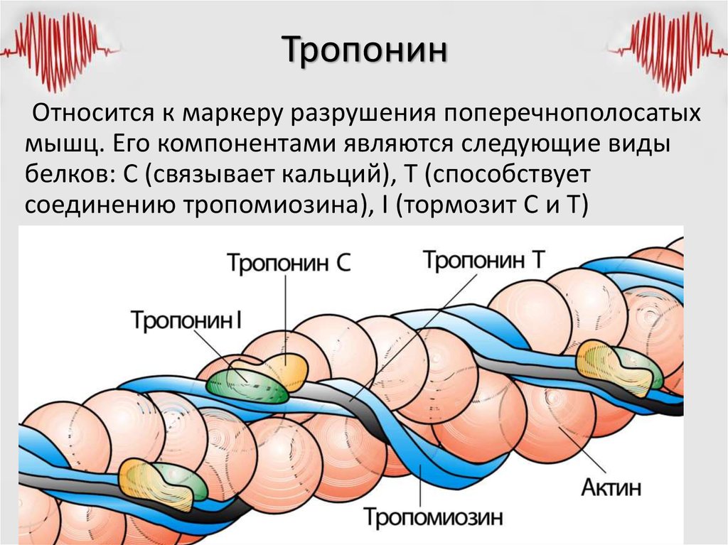 Тропонин анализ цена. Тропонин норма и при инфаркте миокарда. Кальций тропониновый комплекс. Тропонин-тропомиозиновый комплекс. Тропонин т и i при инфаркте миокарда.