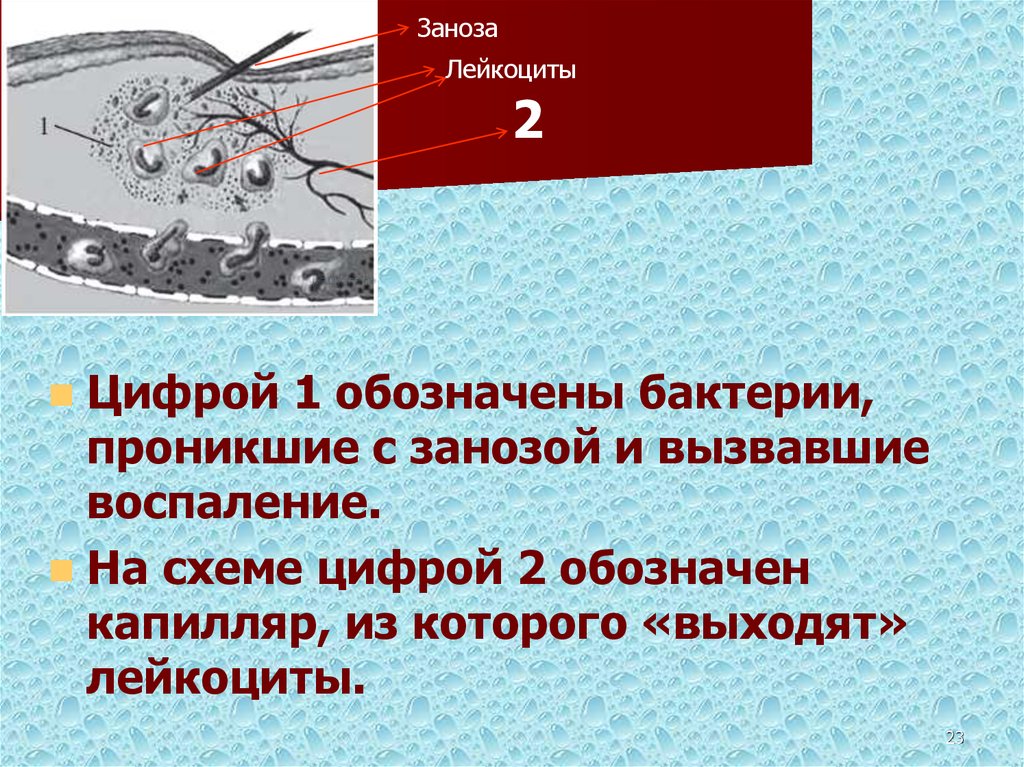 Рассмотрите схему воспалительного процесса