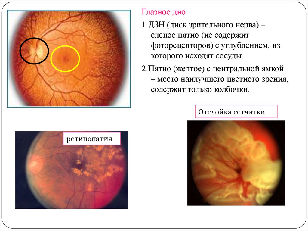 Диск зрительного нерва. Диск зрительного нерва анатомия. Диск зрительного нерва сетчатки анатомия. Диск зрительного нерва и слепое пятно. Ямка ДЗН зрительного нерва.