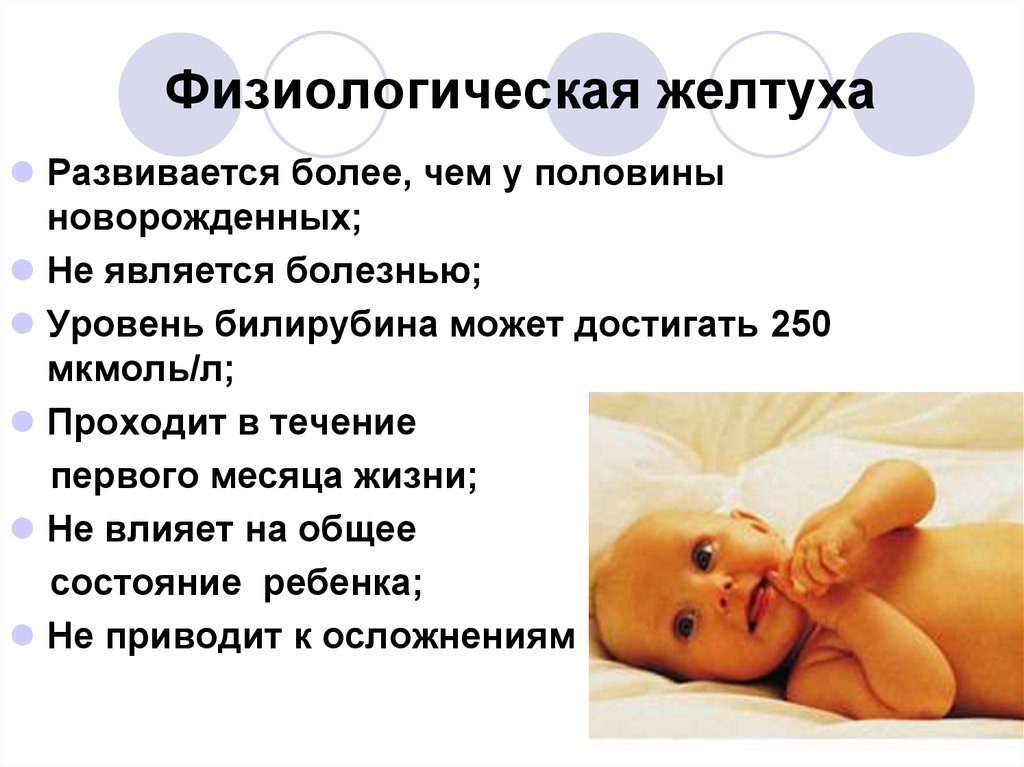 Желтушка новорожденных сколько дней. Физиологическая желтуха новорожденных характеризуется. Физиологическая желтуха новорожденных билирубин. Физиологическая желтуха у новорожденных норма. Критерии физиологической желтухи новорожденных.
