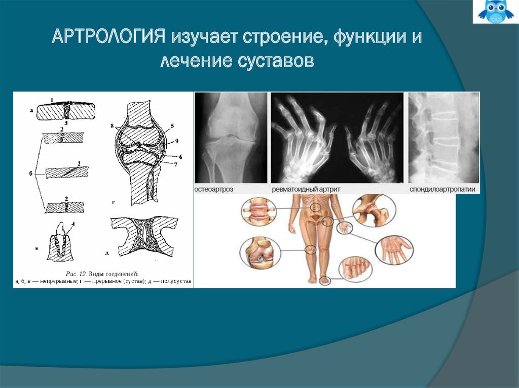 Артрология. Артрология функции. Артрология строение. Непрерывные соединения артрология.