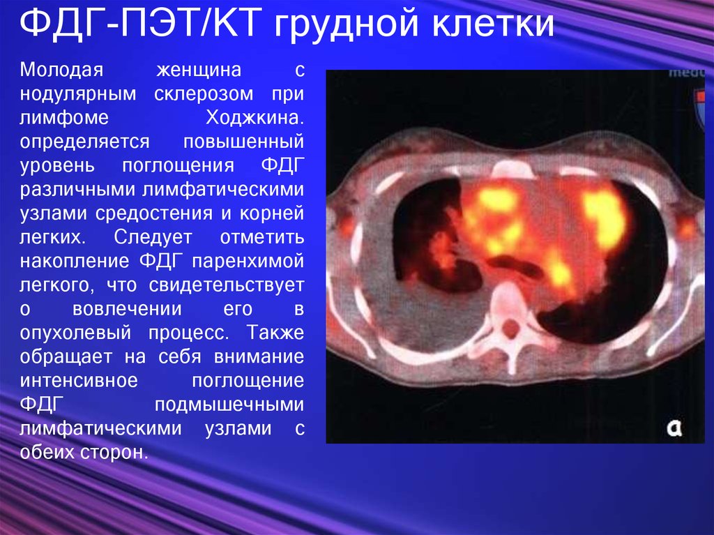 Презентация пэт кт