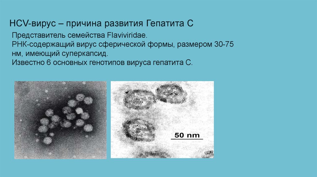 Генотип вируса 1b. Вирус гепатита в. Вирус гепатита с (HCV). Гепатит а как выглядит вирус. Гепатит с история возникновения.