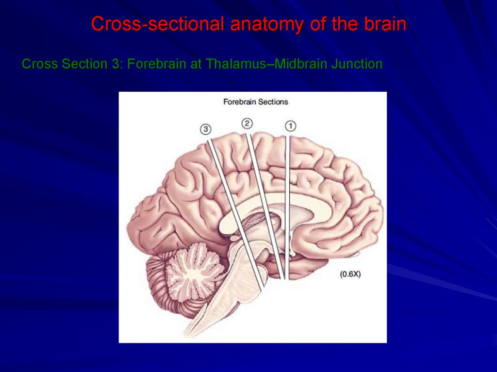 Cross-sectional anatomy of the brain