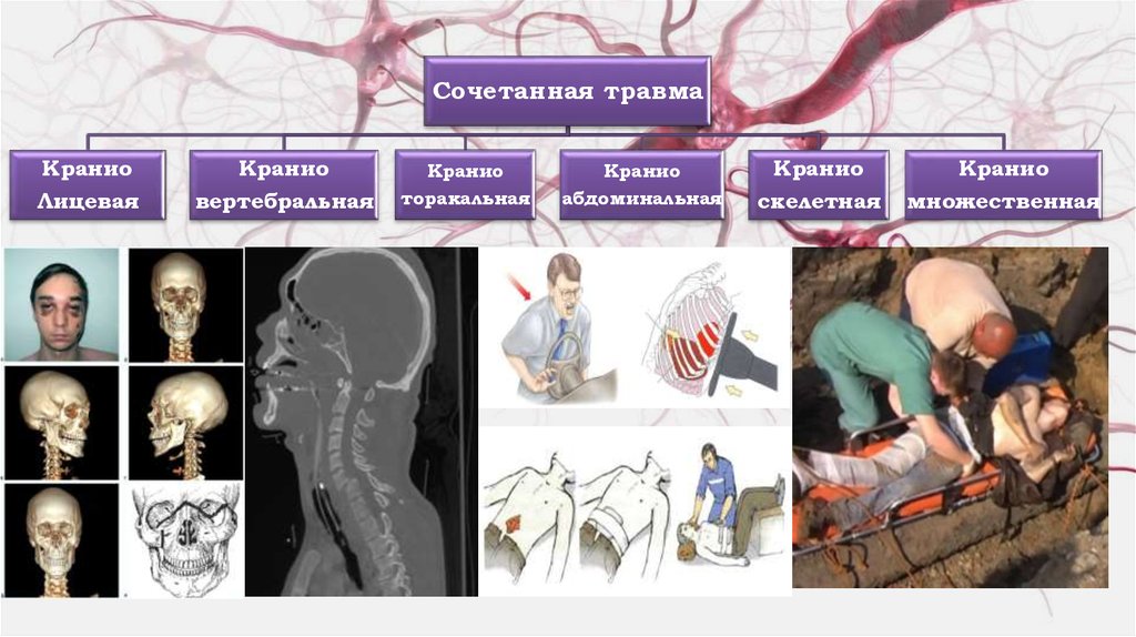 Neurotrauma