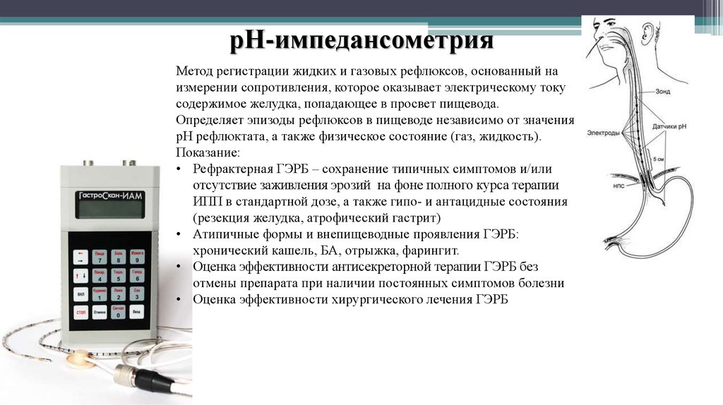 Метод регистрации. Суточная РН импедансометрия пищевода. Импеданс PH метрия суточная. 24 Часовая PH импедансометрия пищевода. Внутрипищеводная импедансометрия.