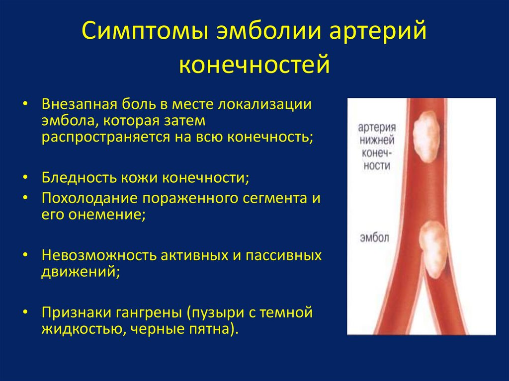 Тромб определение. Эмболия бедренной артерии клиника. Острые тромбоэмболии артерий конечностей. Эмболия периферических артерий. Острые артериальные тромбозы и эмболии магистральных сосудов.