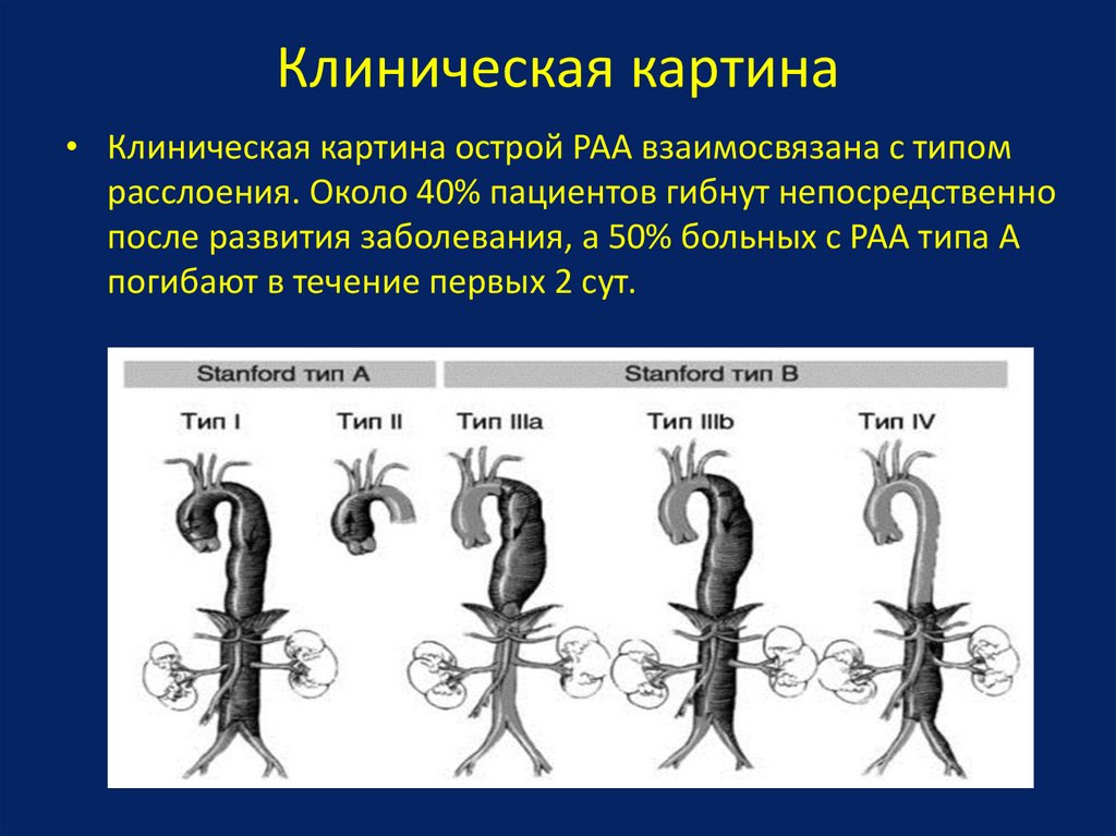Мезентериальный тромбоз мкб 10. Мезентериальный венозный тромбоз кт. Тромбоз мезентериальных сосудов на кт. Клиническая картина тромбоза. Острый тромбоз артерий классификация.